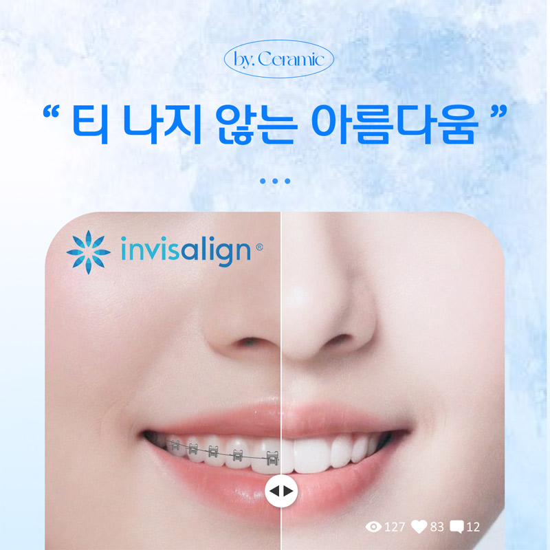 세계적인 신뢰, 인비절라인 치아 교정 이벤트 썸네일 이미지