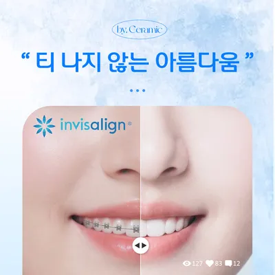 세계적인 신뢰, 인비절라인 치아 교정 이벤트 썸네일 이미지