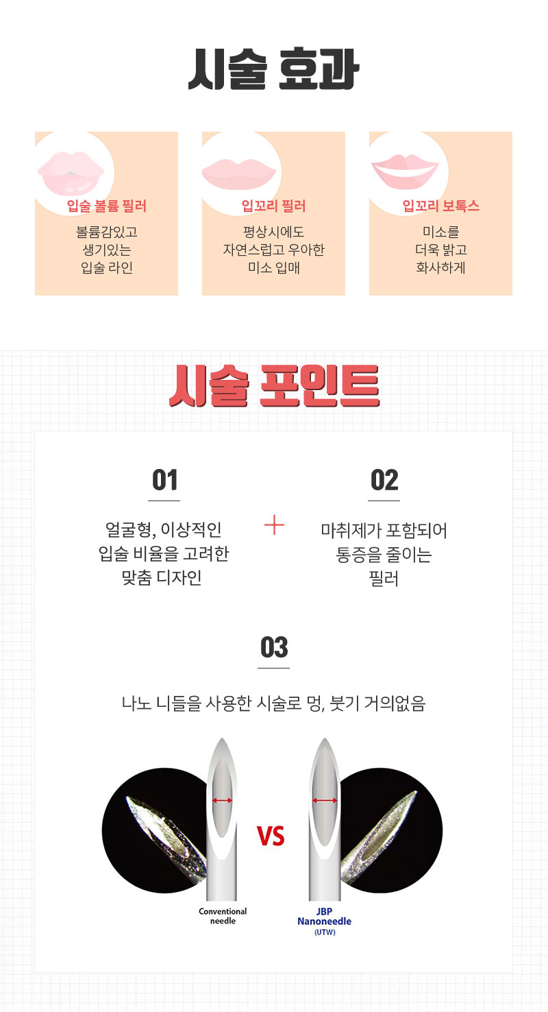 온리원클리닉의원 국산 입술필러 1 cc 이벤트, 시술 상세 이미지