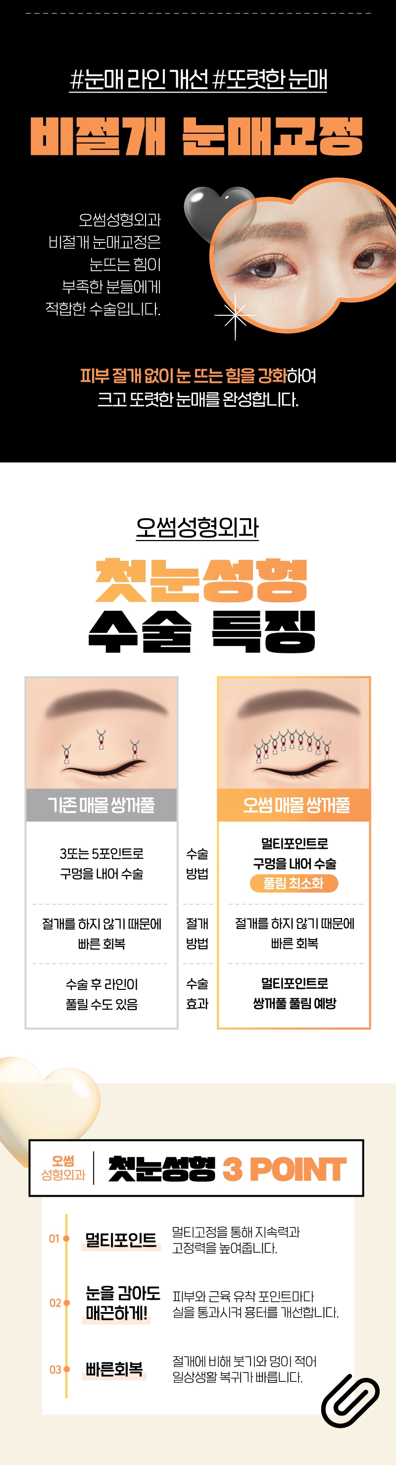 오썸성형외과 강남역 오썸 첫눈성형 이벤트, 시술 상세 이미지