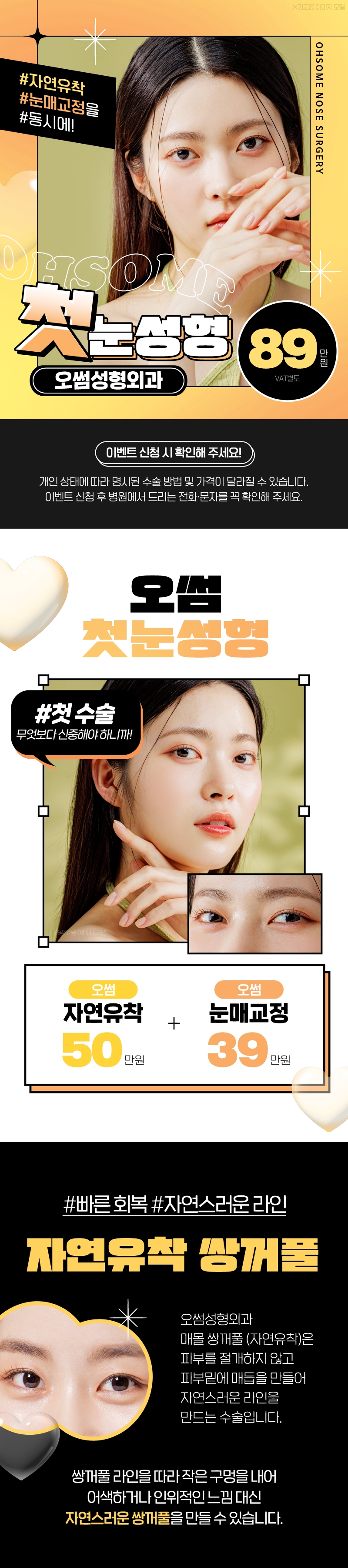 오썸성형외과 강남역 오썸 첫눈성형 이벤트, 시술 상세 이미지