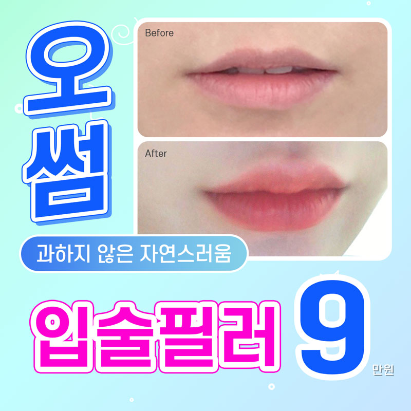 오썸 디자인 입술필러 이벤트 썸네일 이미지