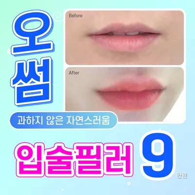 오썸 디자인 입술필러 이벤트 썸네일 이미지