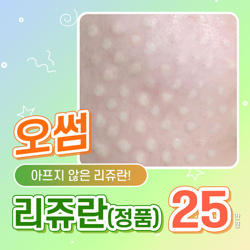 오썸 리쥬란 정품 이벤트 썸네일 이미지