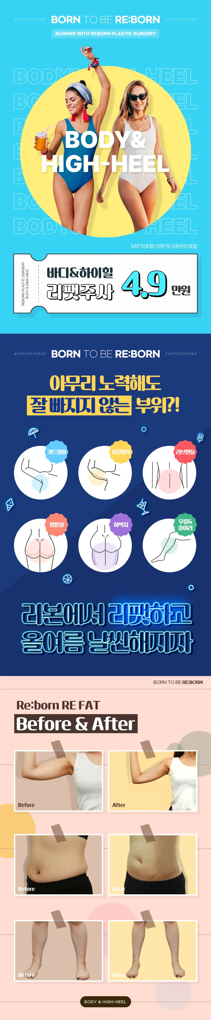 리본성형외과 ★지방분해리팻주사4.9 이벤트, 시술 상세 이미지
