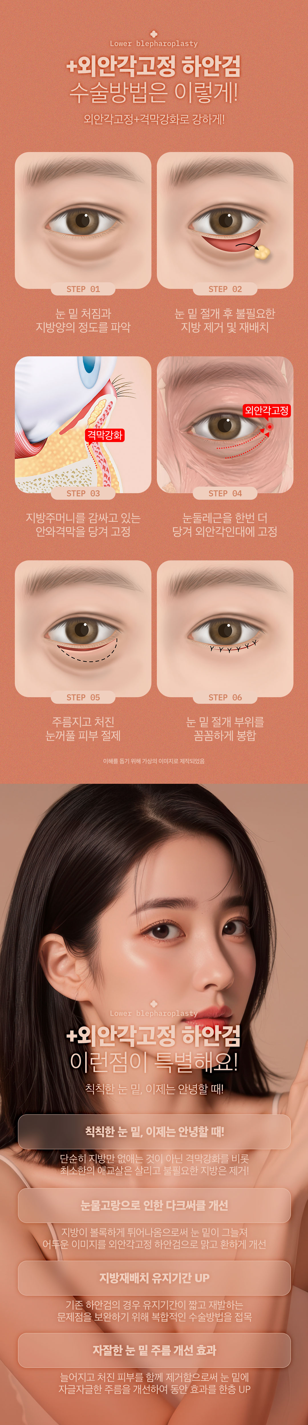 디엠성형외과 ♥디엠 외안각고정 하안검♥ 이벤트, 시술 상세 이미지