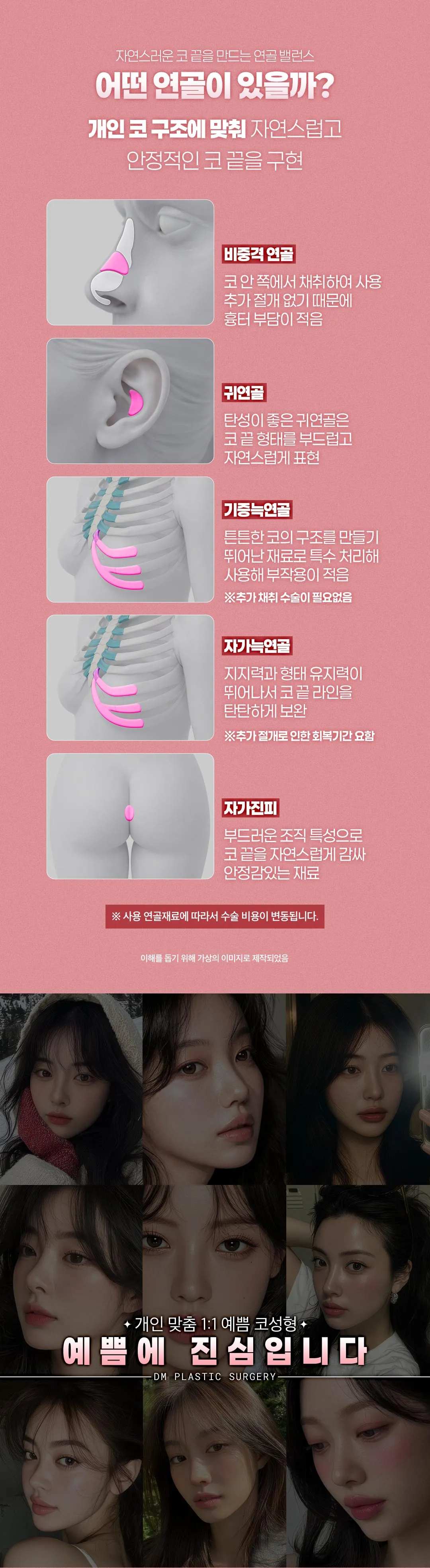 디엠성형외과 ♥디엠 첫 코성형 ♥ 이벤트, 시술 상세 이미지
