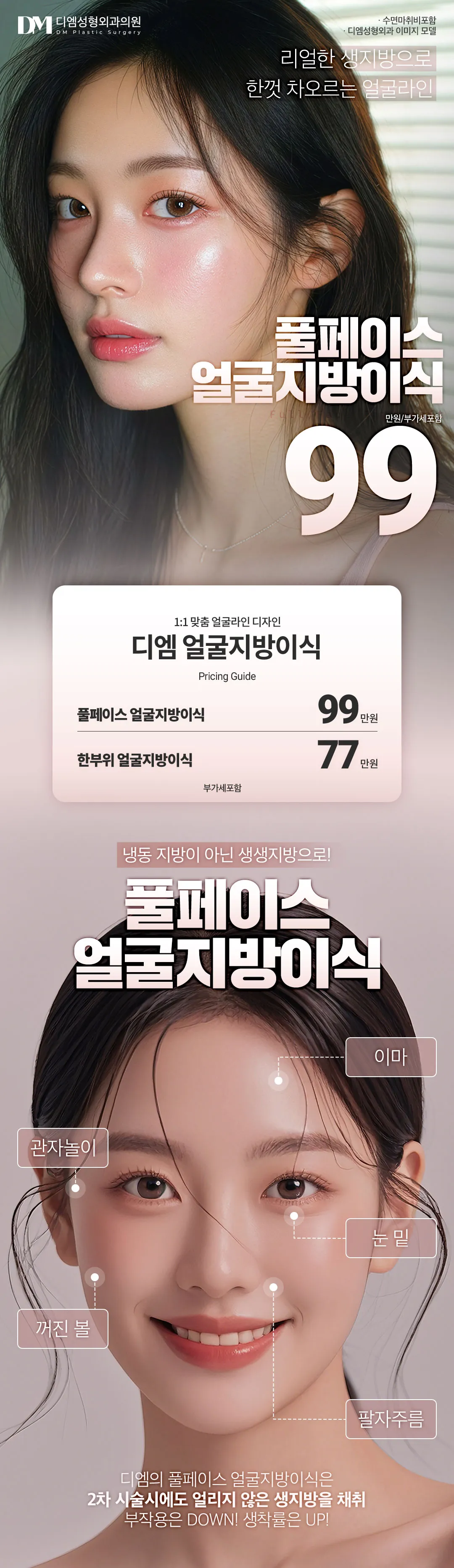 디엠성형외과 ★풀페이스 얼굴지방이식★ 이벤트, 시술 상세 이미지