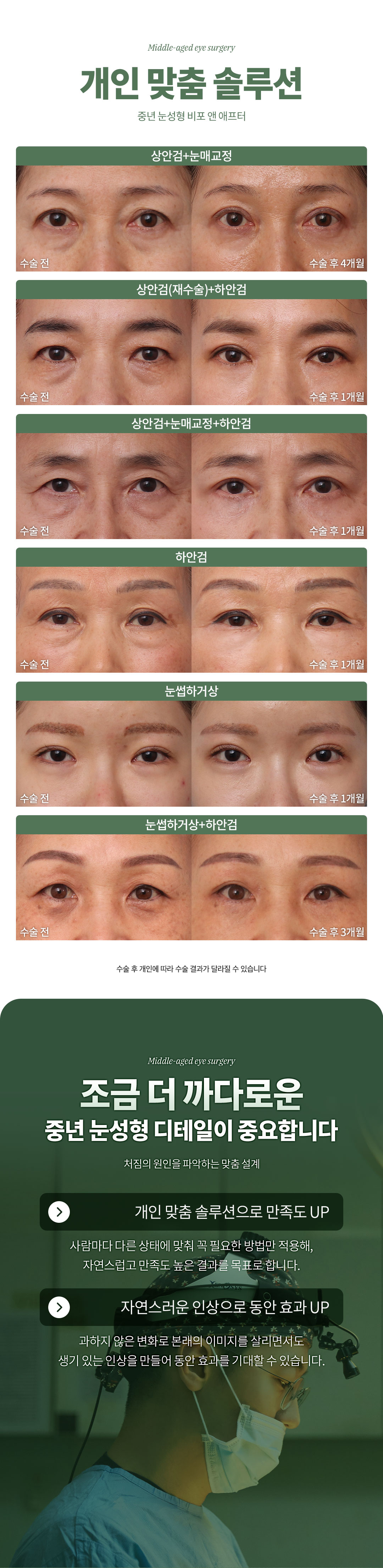 디엠성형외과 ♥디엠 중년눈성형♥ 이벤트, 시술 상세 이미지