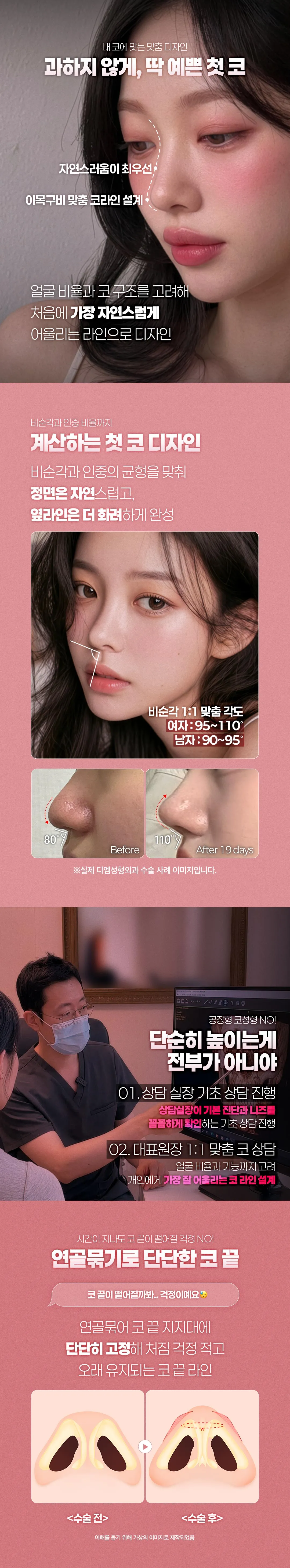 디엠성형외과 ♥디엠 첫 코성형 ♥ 이벤트, 시술 상세 이미지