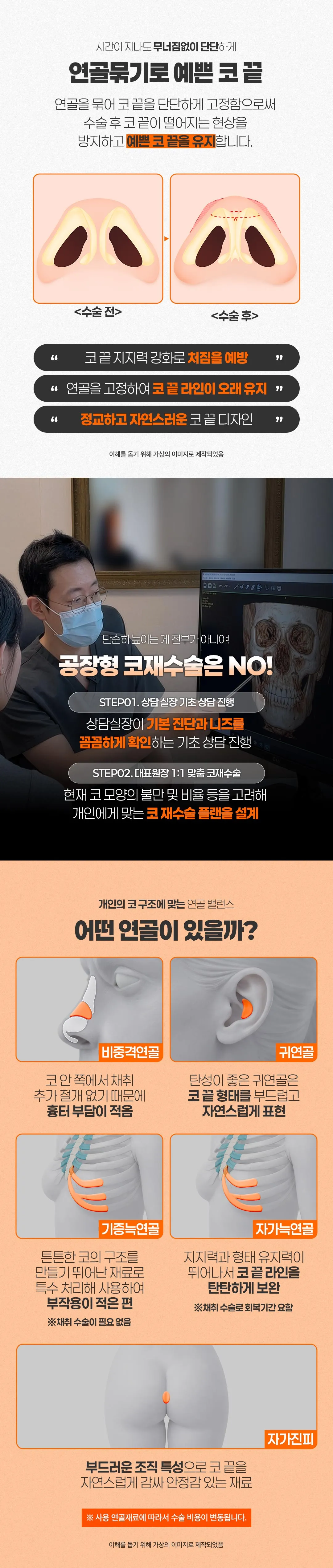 디엠성형외과 ❤ 디엠 코재수술 ❤ 이벤트, 시술 상세 이미지