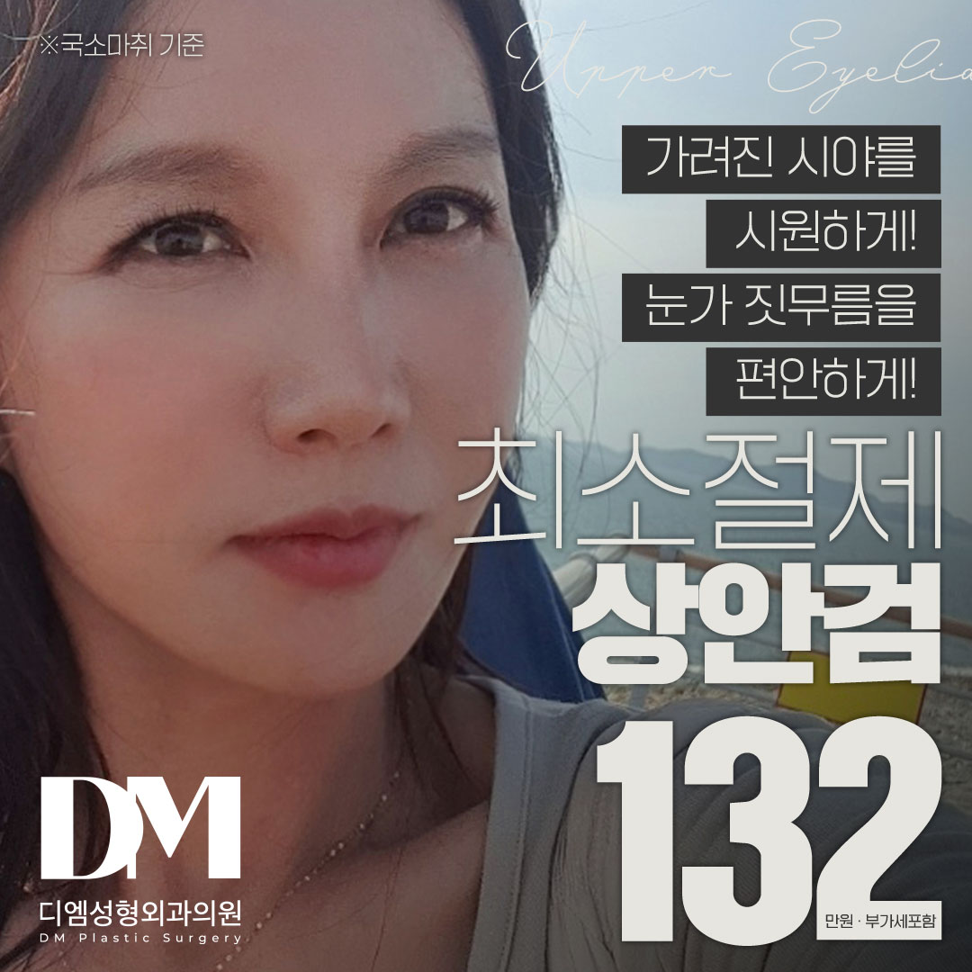♥최소절제 상안검♥ 이벤트 썸네일 이미지