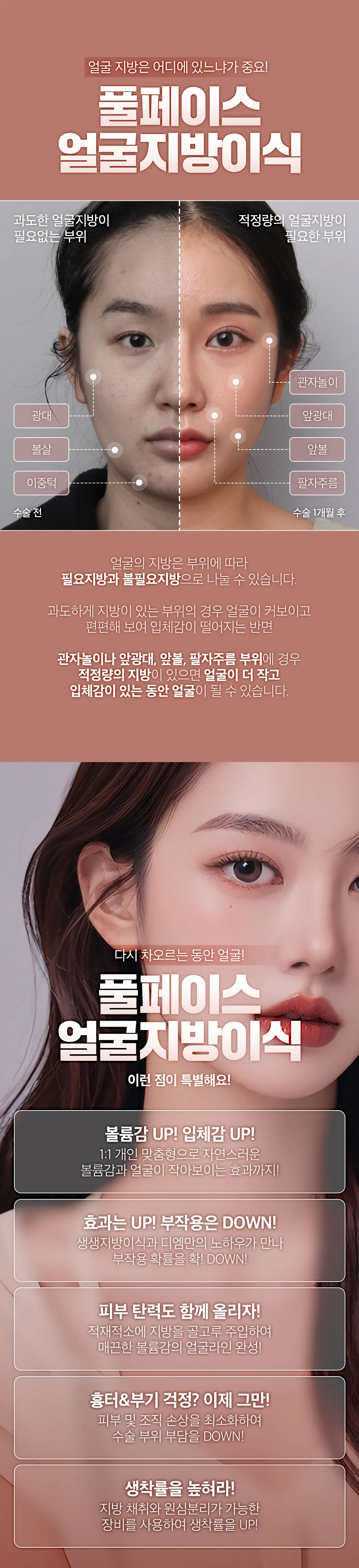 디엠성형외과 ★풀페이스 얼굴지방이식★ 이벤트, 시술 상세 이미지