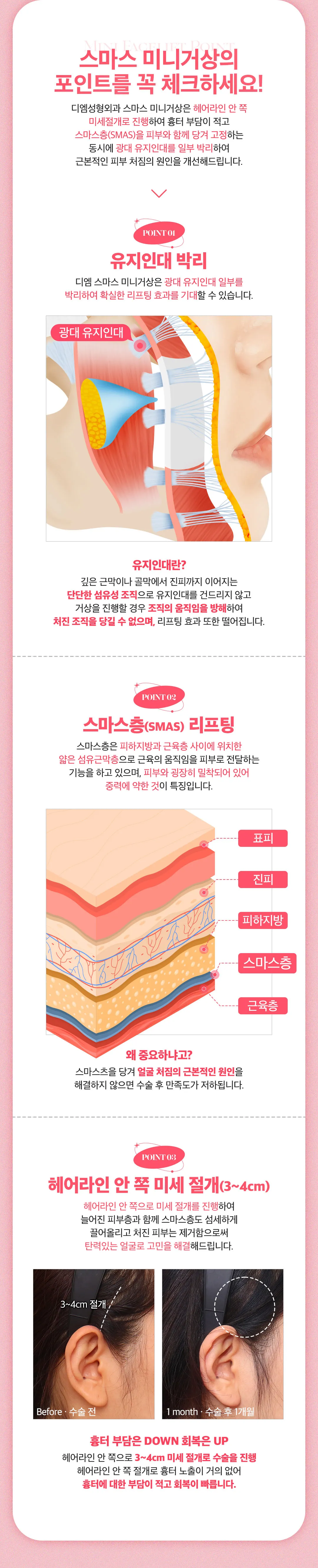 event detail