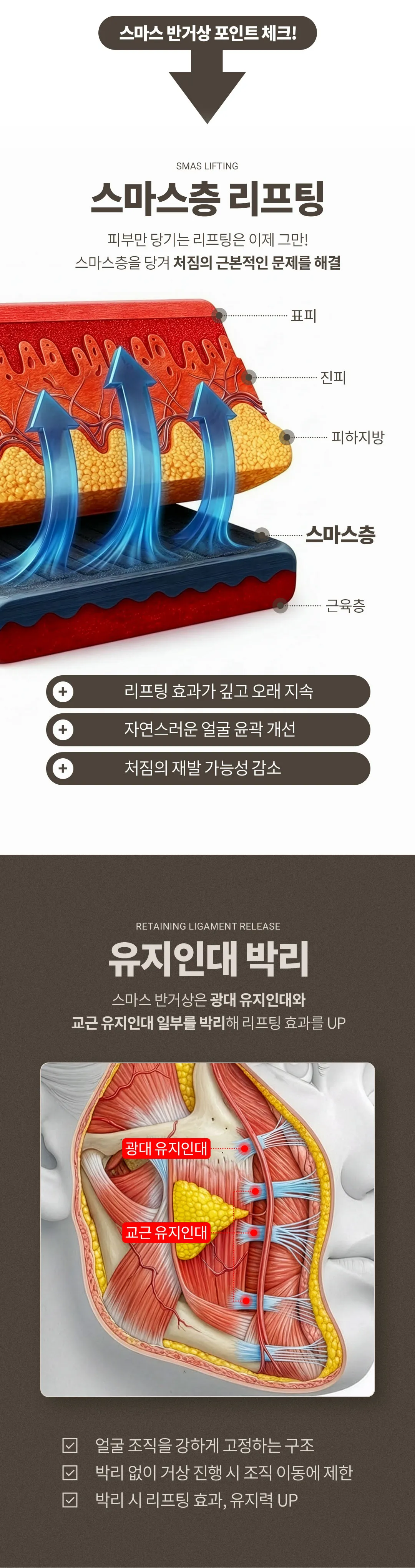 디엠성형외과 ♥디엠 스마스 반거상♥ 이벤트, 시술 상세 이미지