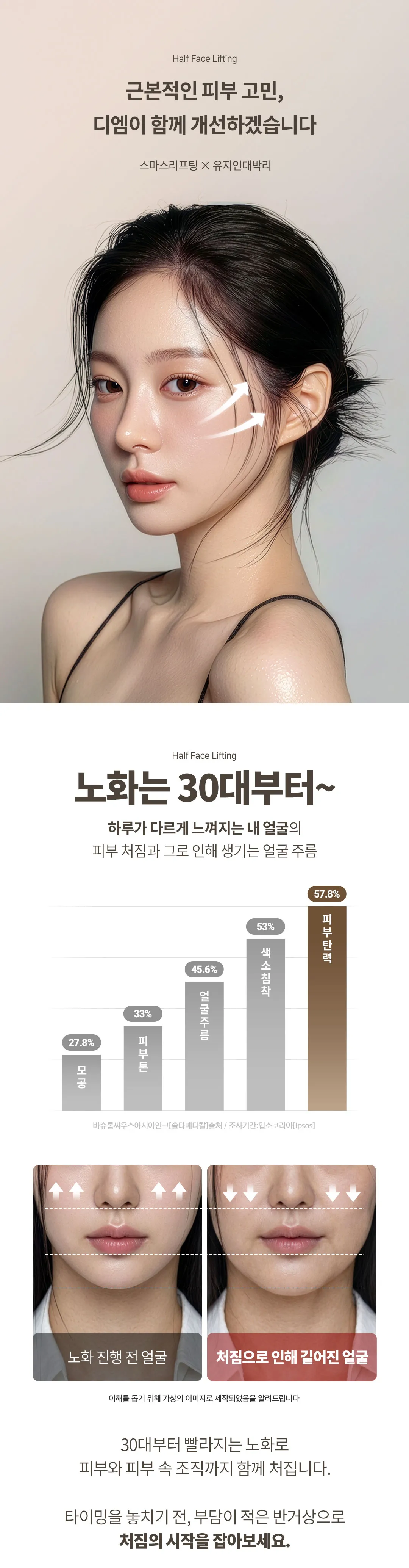 디엠성형외과 ♥디엠 스마스 반거상♥ 이벤트, 시술 상세 이미지