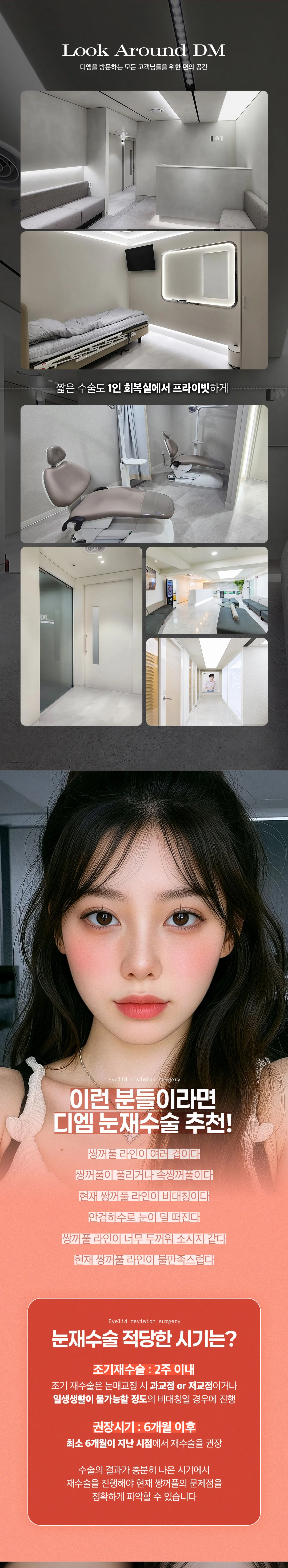 디엠성형외과 ❤디엠❤ 눈재수술 이벤트, 시술 상세 이미지