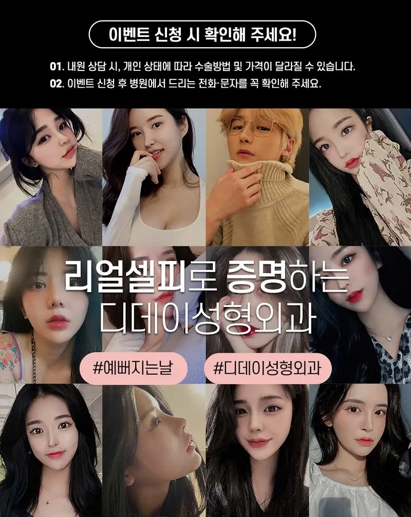 코라인은 디데이! 디데이 첫코성형!