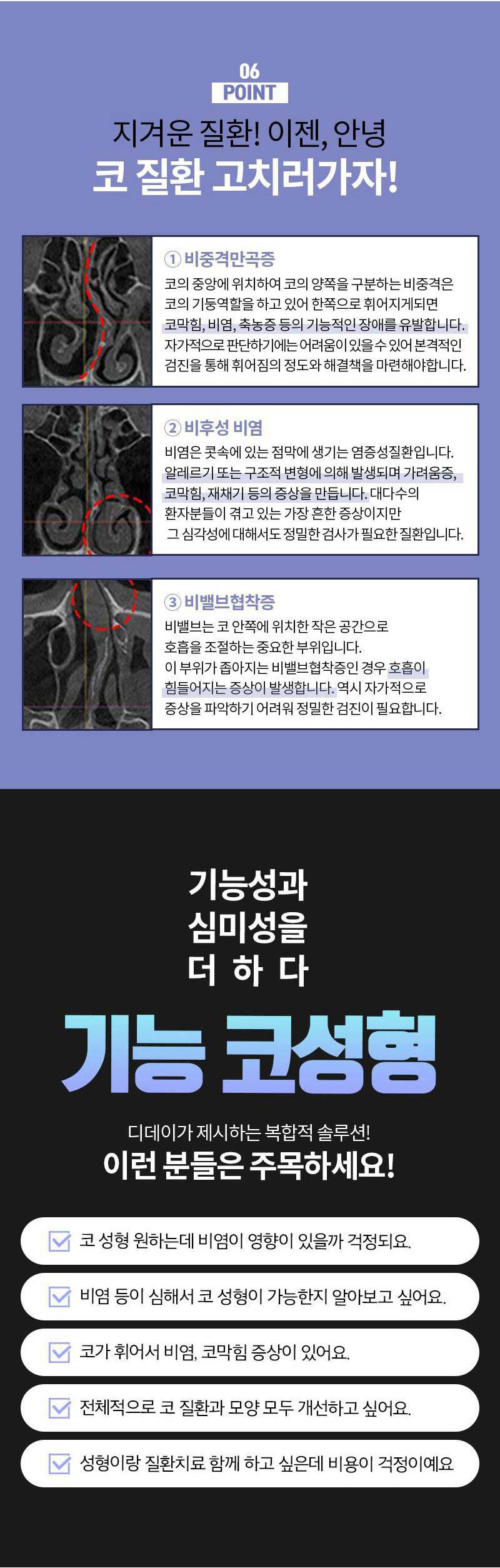 디데이성형외과의원 비염+미용 디데이 가벼운기능코 30 이벤트, 시술 상세 이미지