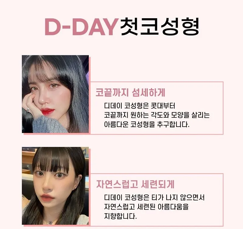 코라인은 디데이! 디데이 첫코성형!
