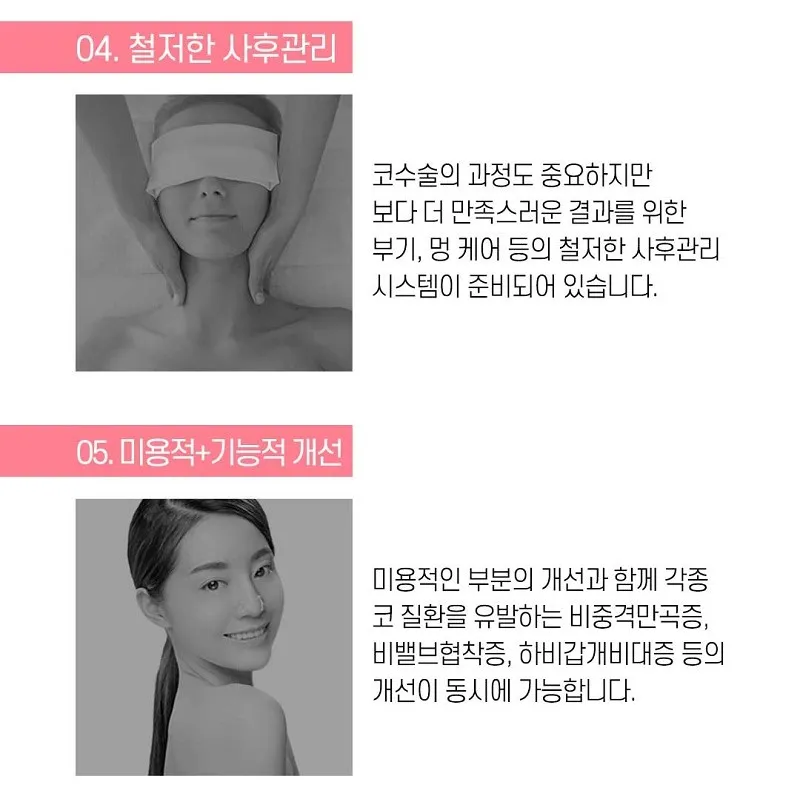 코라인은 디데이! 디데이 첫코성형!