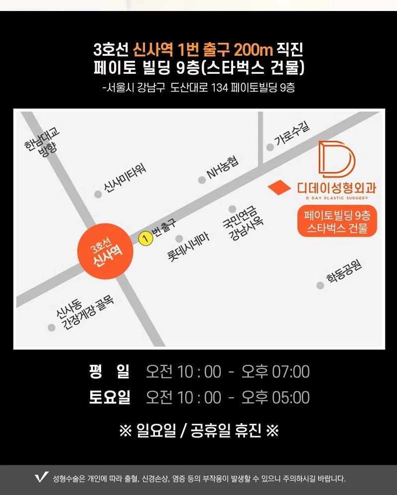 코라인은 디데이! 디데이 첫코성형!