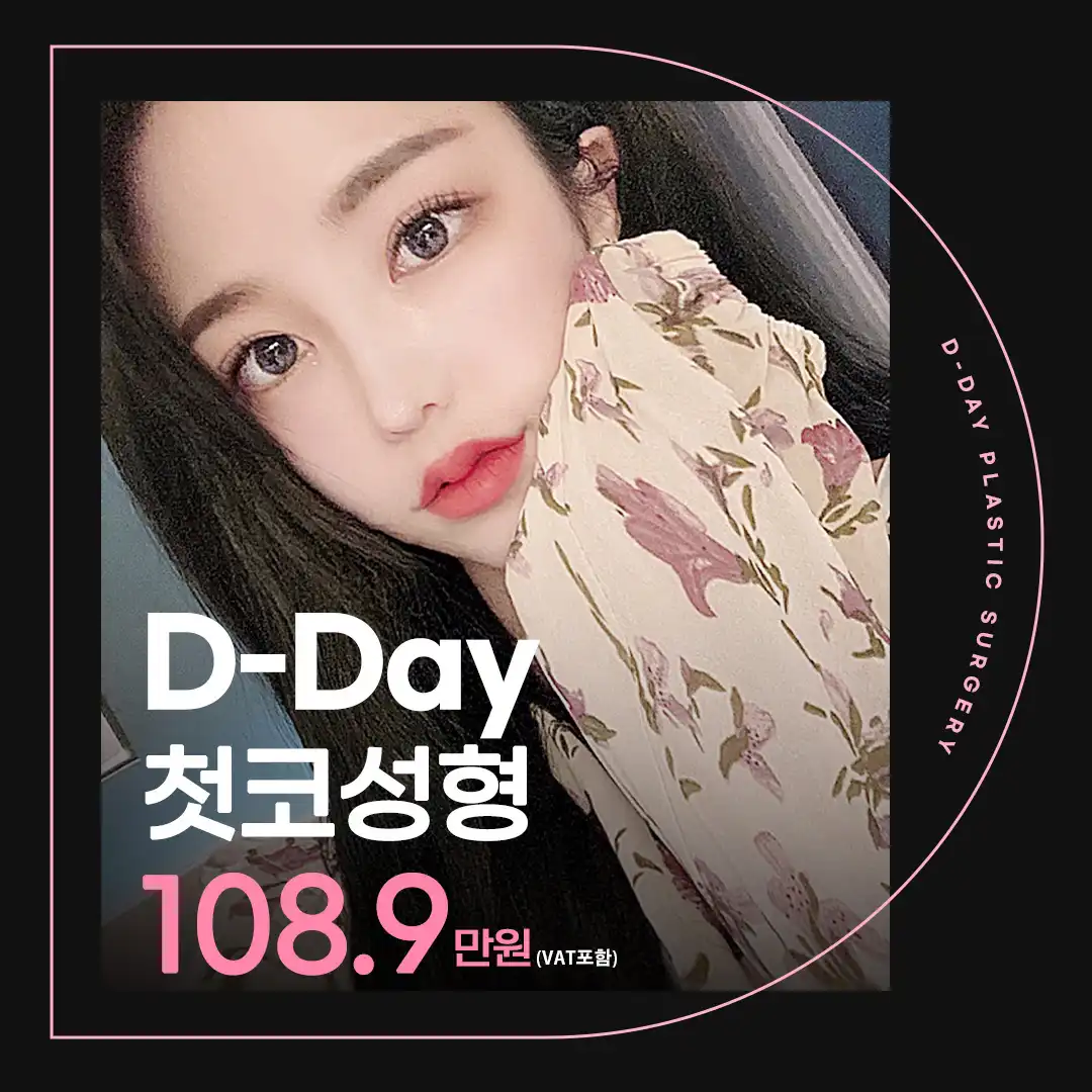 코라인은 디데이! 디데이 첫코성형!