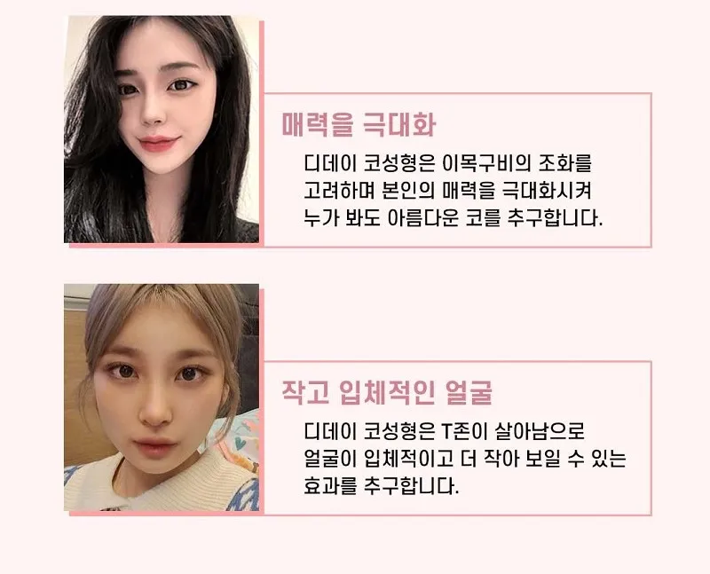 코라인은 디데이! 디데이 첫코성형!