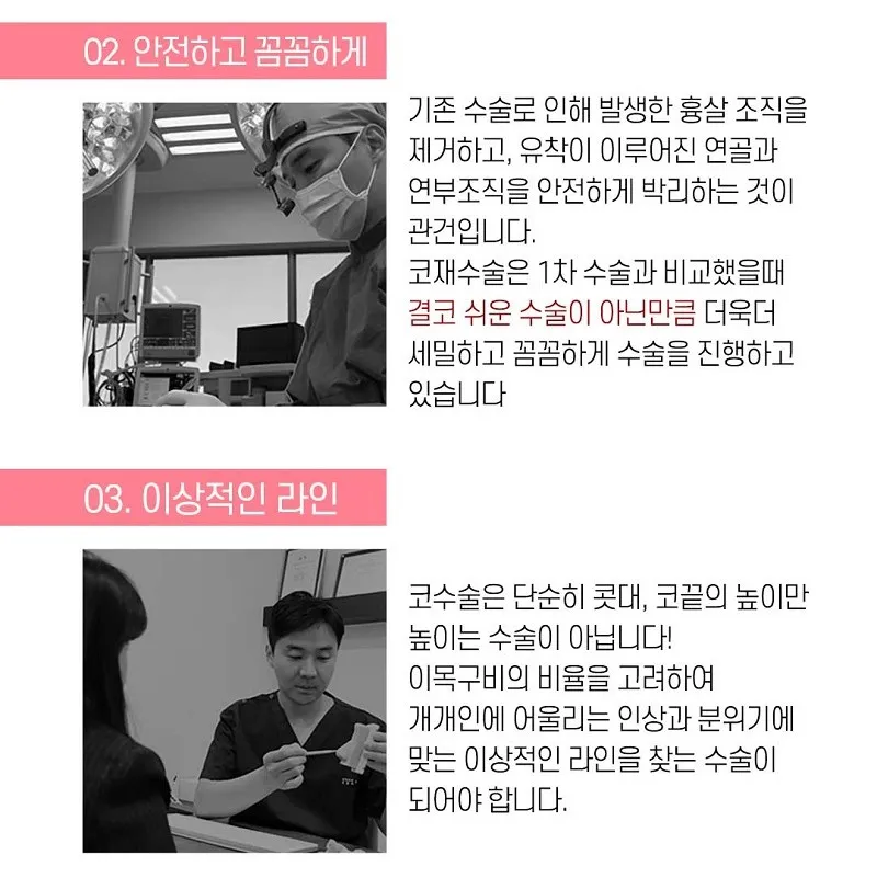 코라인은 디데이! 디데이 첫코성형!