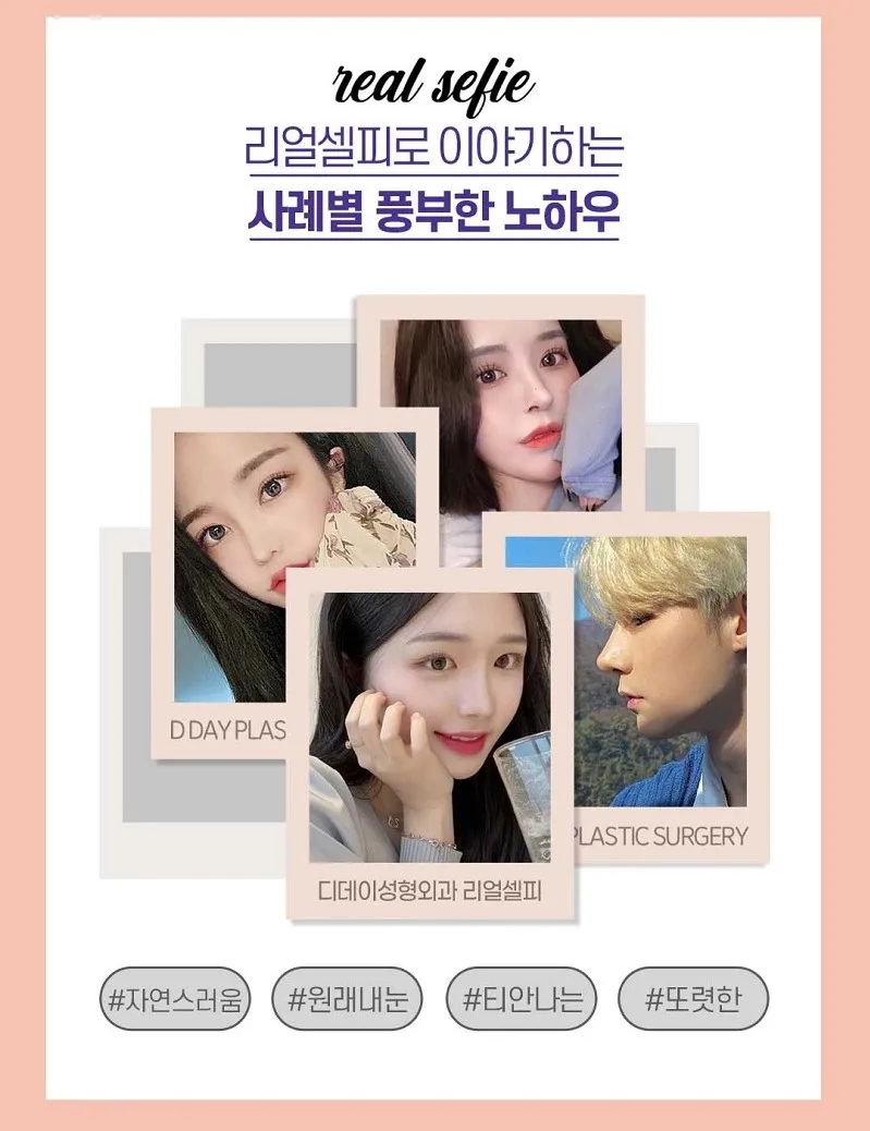 코라인은 디데이! 디데이 첫코성형!