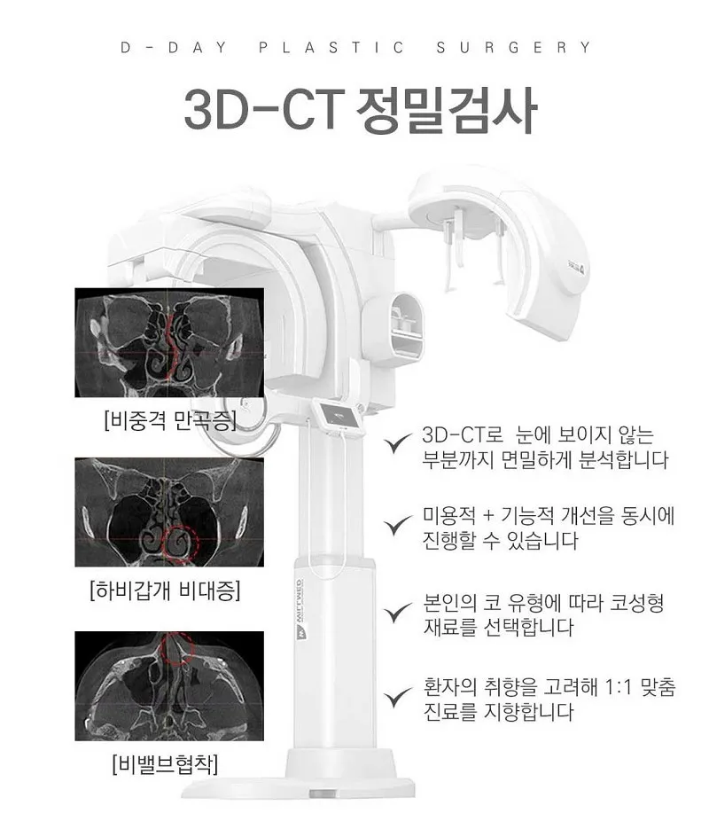 코라인은 디데이! 디데이 첫코성형!