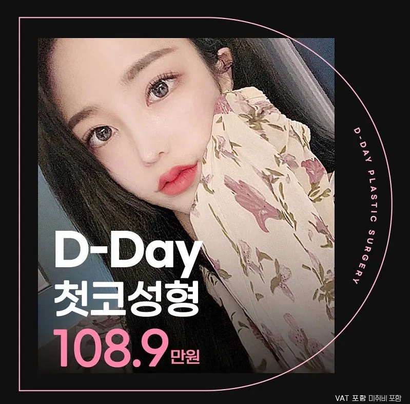 코라인은 디데이! 디데이 첫코성형!