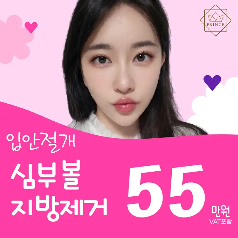 입안절개 심부볼지방제거