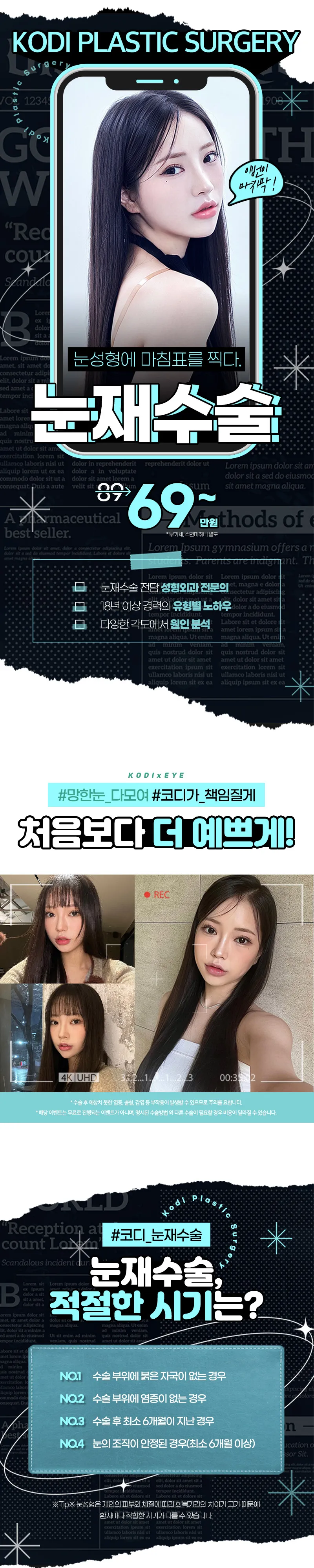 코디성형외과 코디★눈재수술 이벤트, 시술 상세 이미지