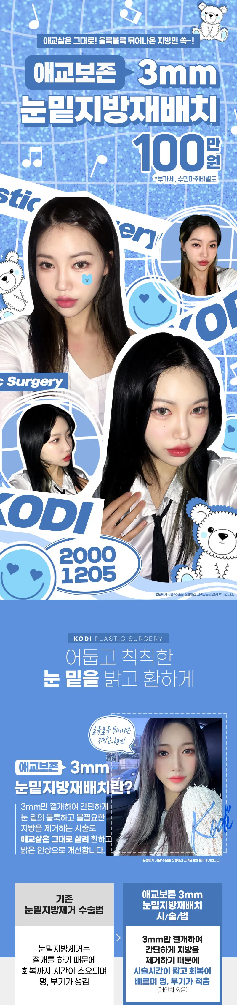 코디성형외과 애교보존 3mms눈밑지방재배치 이벤트, 시술 상세 이미지