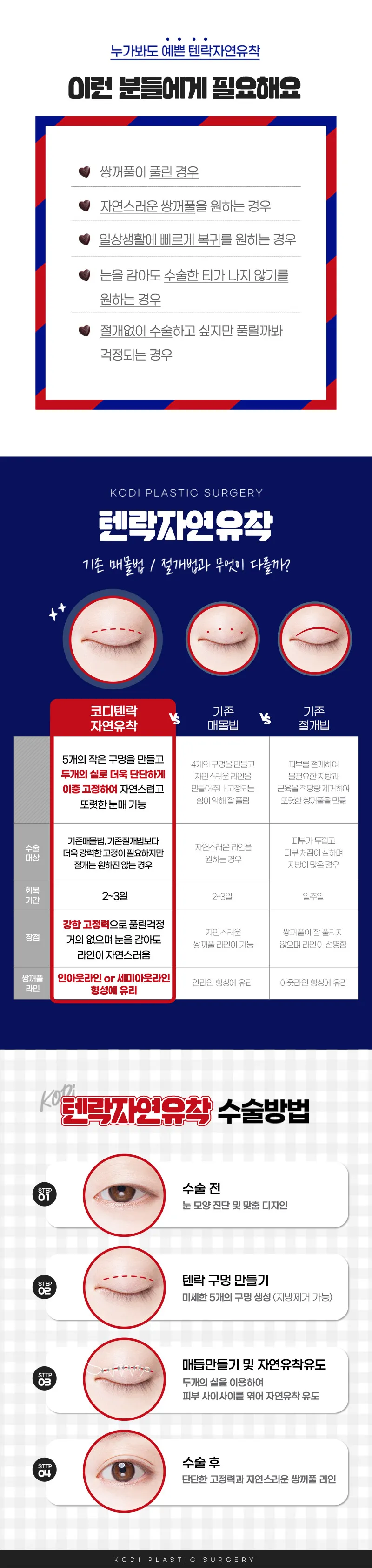 코디성형외과  코디 ＃텐락자연유착 이벤트, 시술 상세 이미지