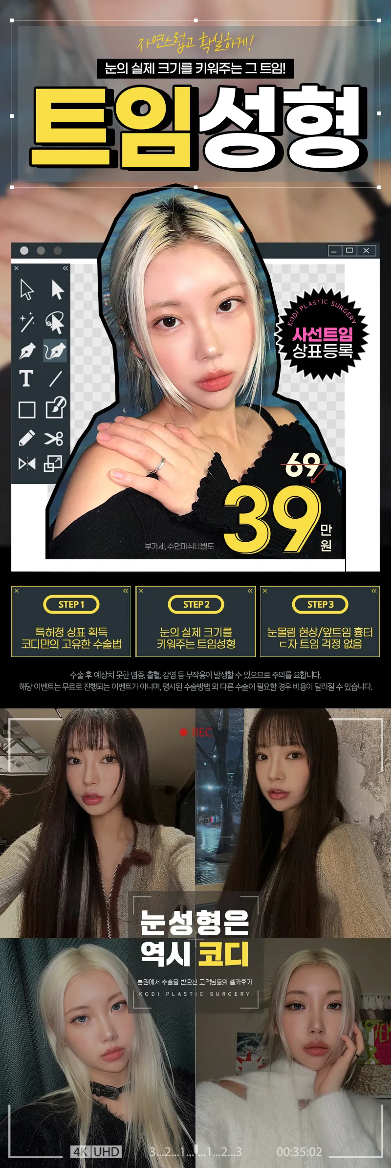 코디성형외과  코디만의 트임성형 모음zip 이벤트, 시술 상세 이미지