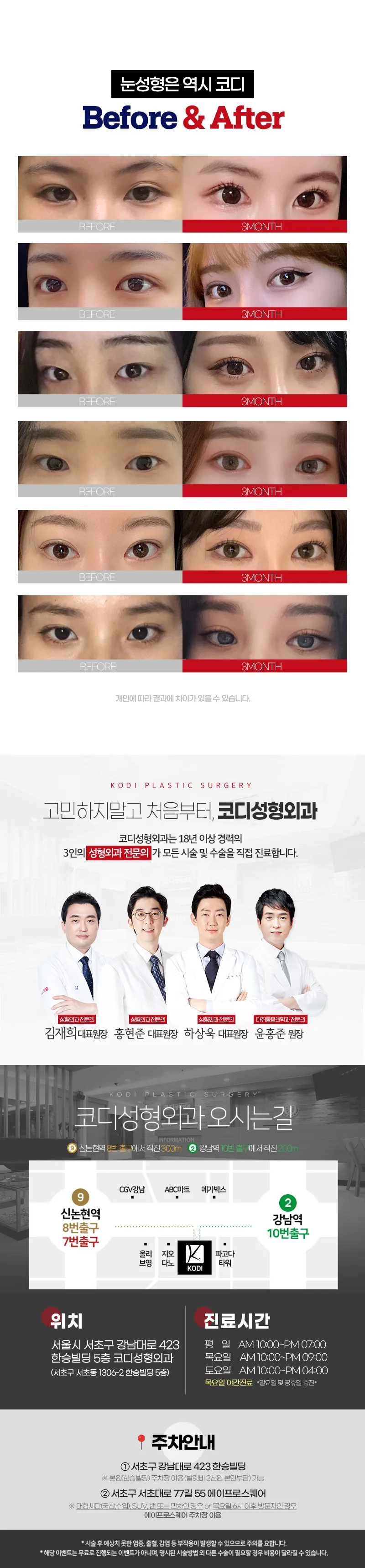 코디성형외과  코디 ＃텐락자연유착 이벤트, 시술 상세 이미지