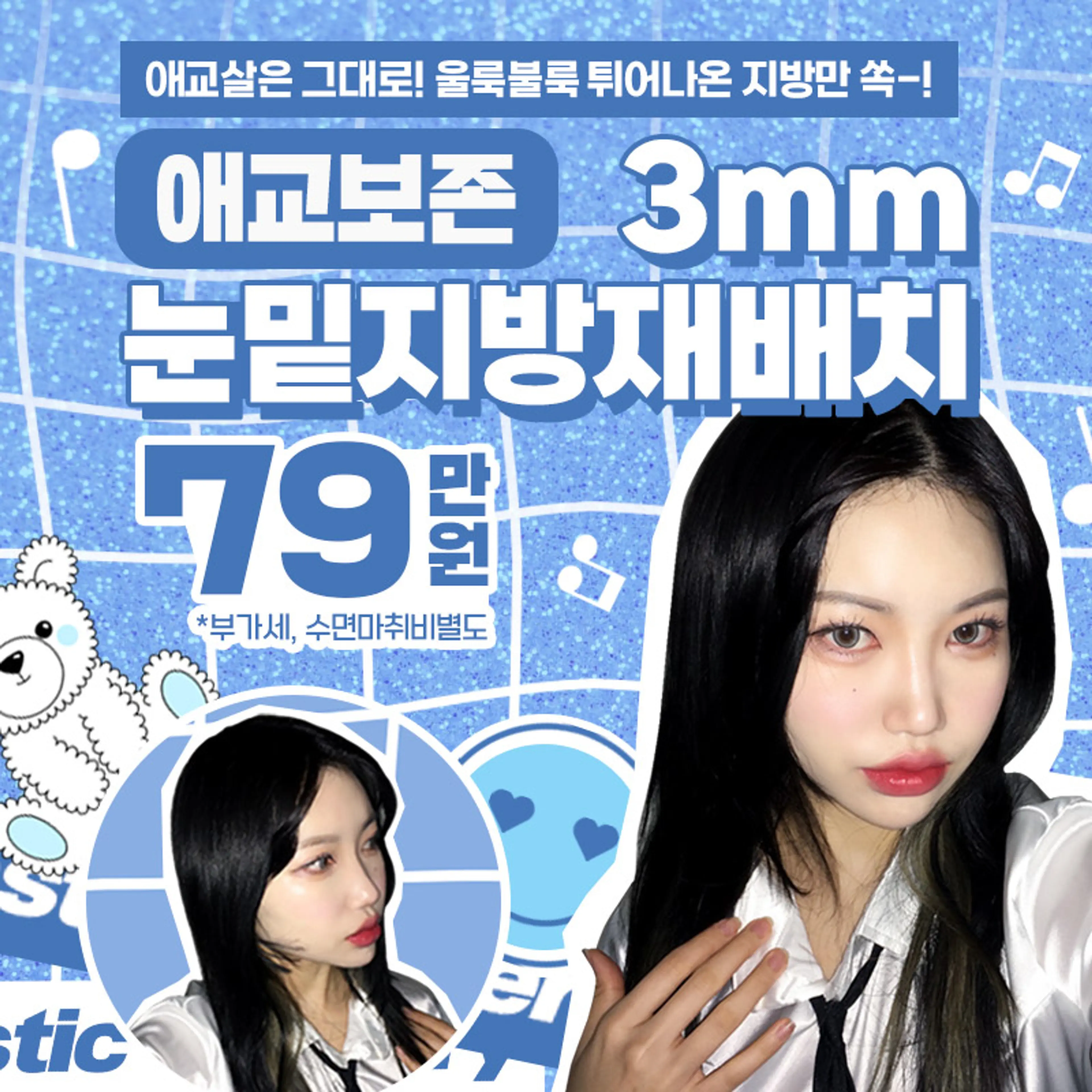 애교보존 3mms눈밑지방재배치