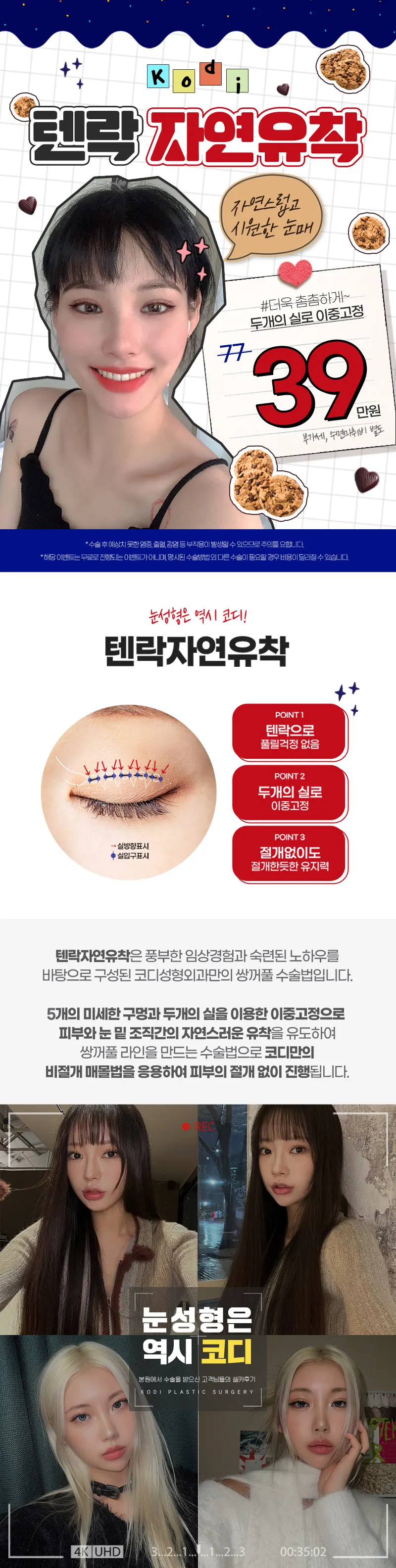 코디성형외과  코디 ＃텐락자연유착 이벤트, 시술 상세 이미지