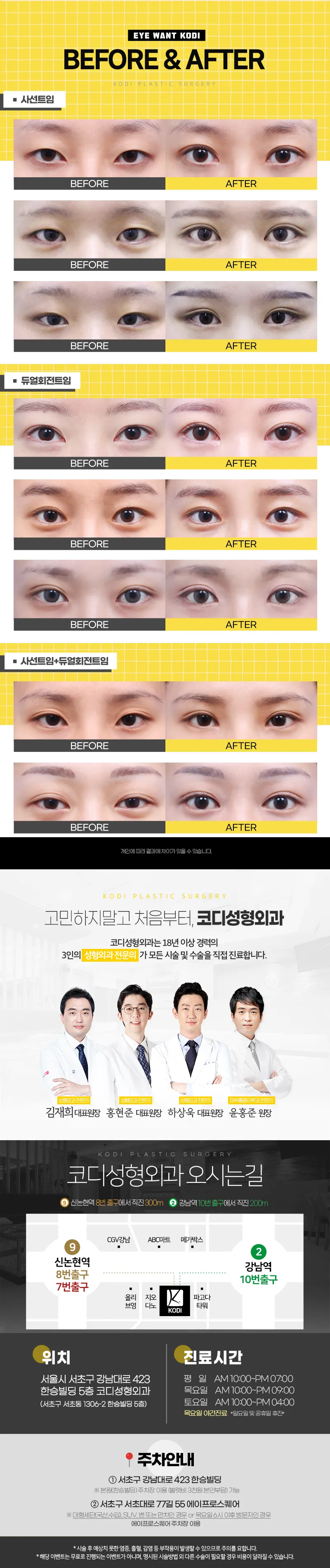 코디성형외과  코디만의 트임성형 모음zip 이벤트, 시술 상세 이미지