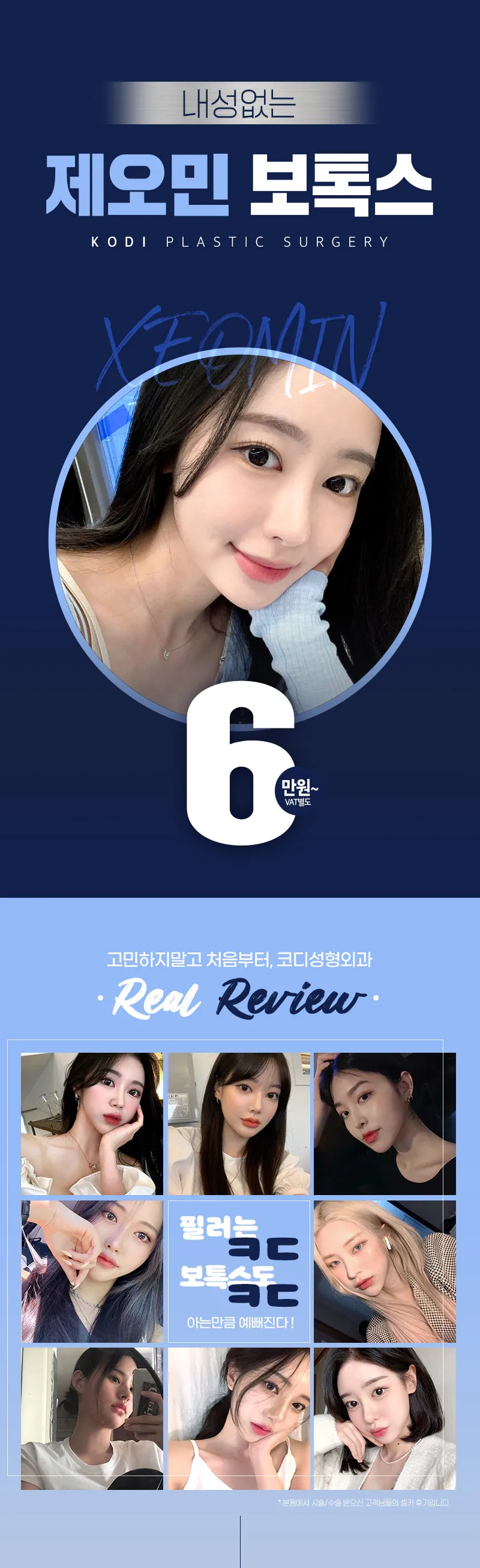 코디성형외과 강남역 제오민 보톡스 이벤트, 시술 상세 이미지