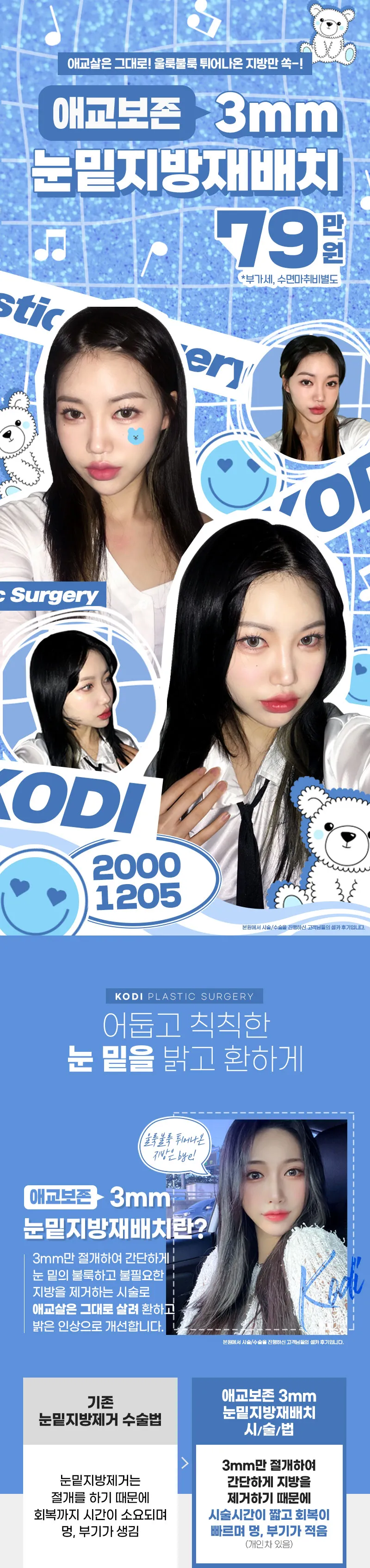 코디성형외과 애교보존 3mms눈밑지방재배치 이벤트, 시술 상세 이미지