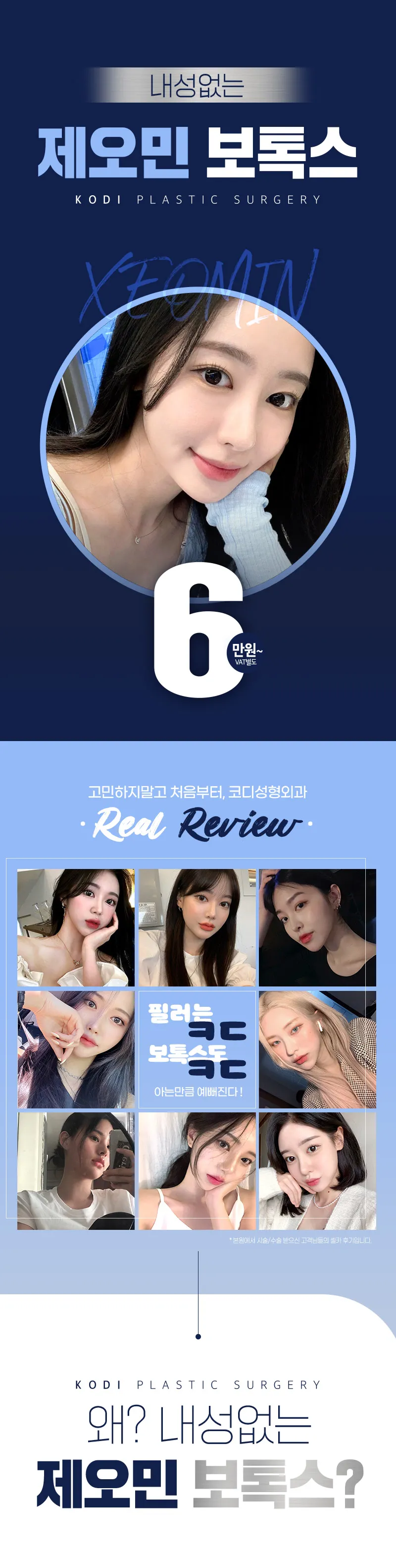 코디성형외과 강남역 제오민 보톡스 이벤트, 시술 상세 이미지