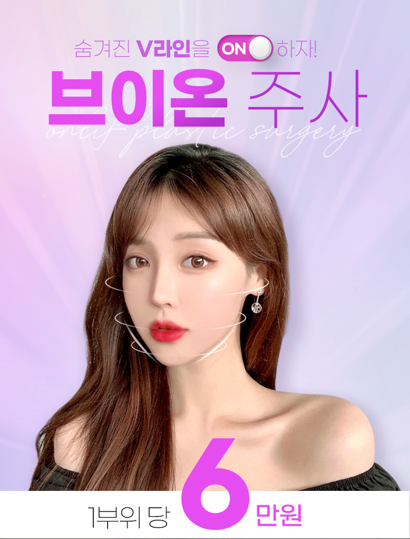 온리프성형외과 브이온 주사_윤곽주사 이벤트, 시술 상세 이미지