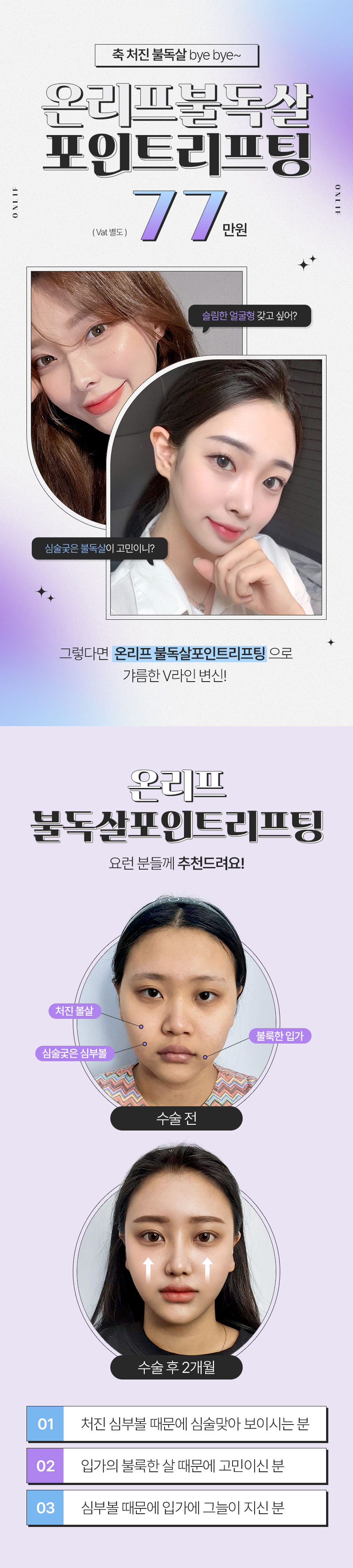 온리프성형외과 온리프 불독살 포인트 리프팅 이벤트, 시술 상세 이미지