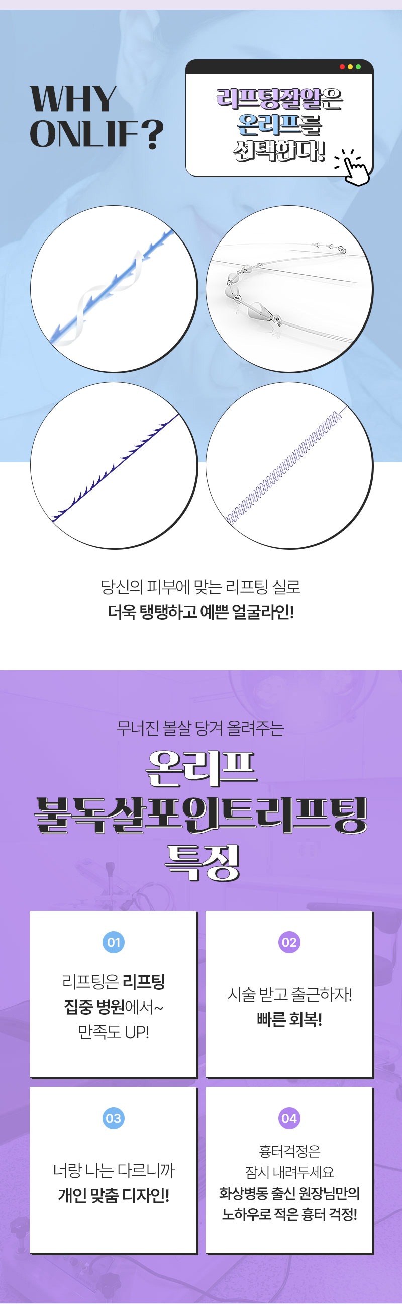 온리프성형외과 온리프 불독살 포인트 리프팅 이벤트, 시술 상세 이미지
