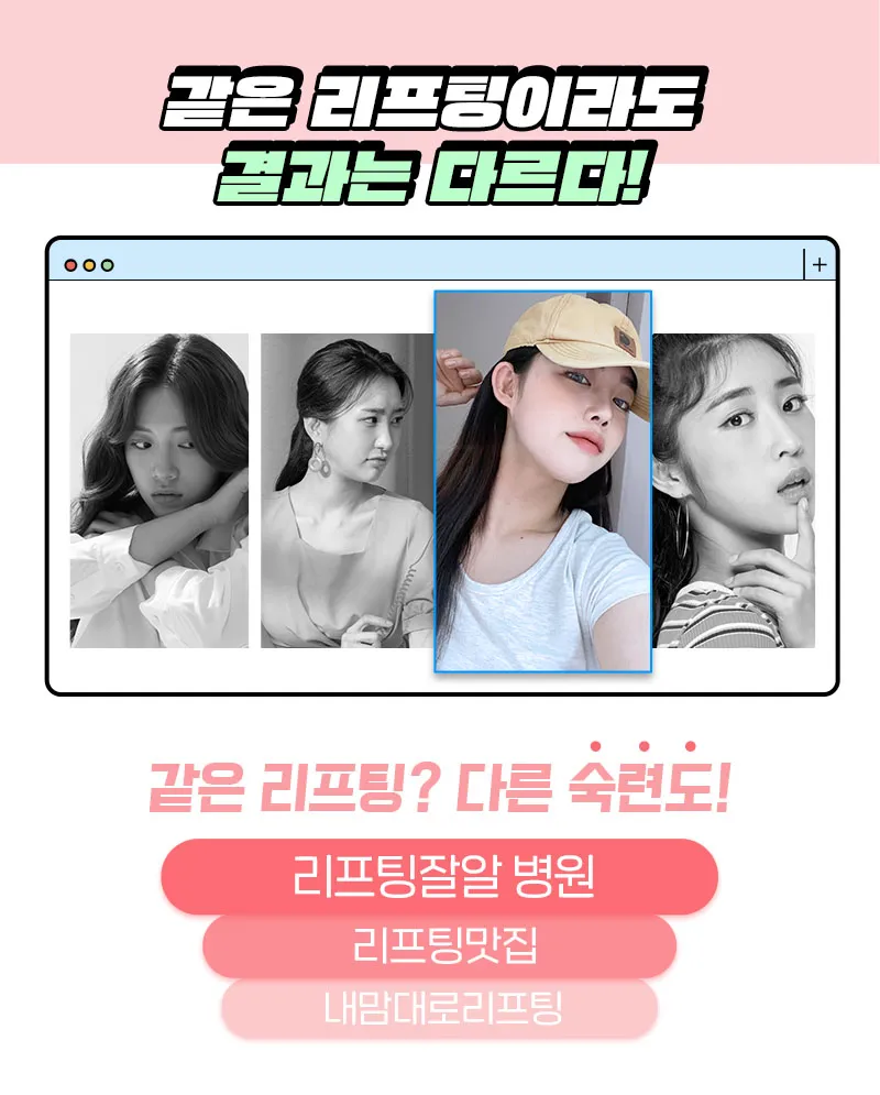 온리프성형외과 ★첫방문 이벤트★슈링크 리프팅 2만원 이벤트, 시술 상세 이미지