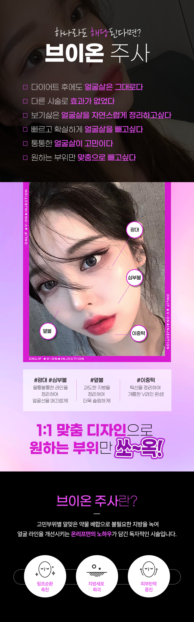 온리프성형외과 브이온 주사_윤곽주사 이벤트, 시술 상세 이미지