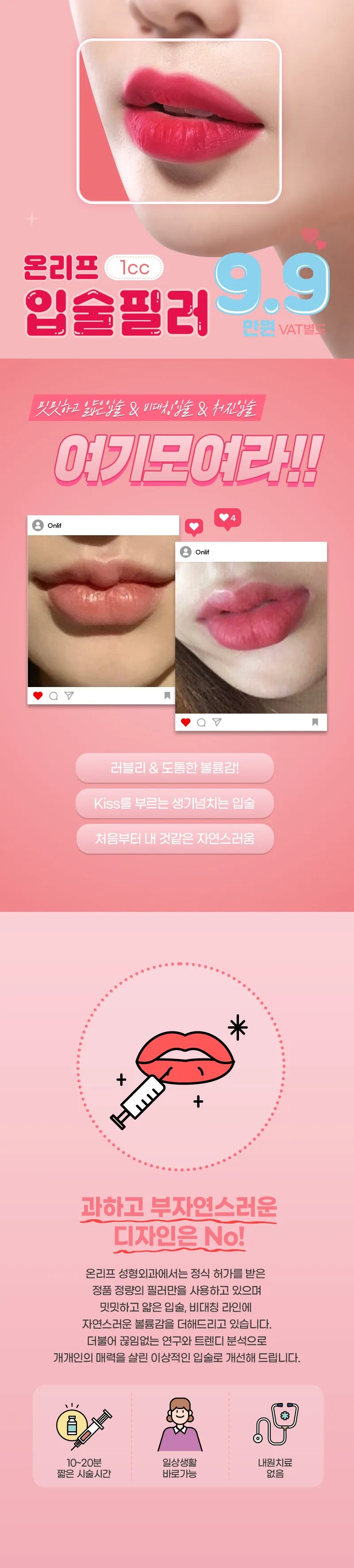 온리프성형외과 과즙톡톡 입술필러 이벤트, 시술 상세 이미지